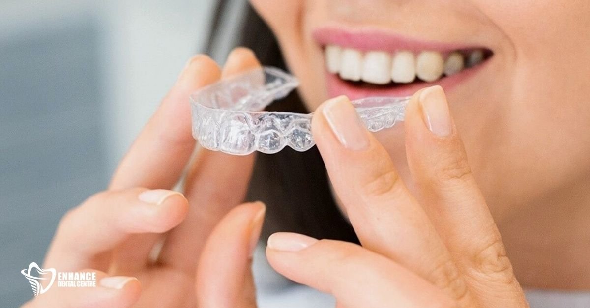 Wearing Invisalign 20 to 22 hours a day