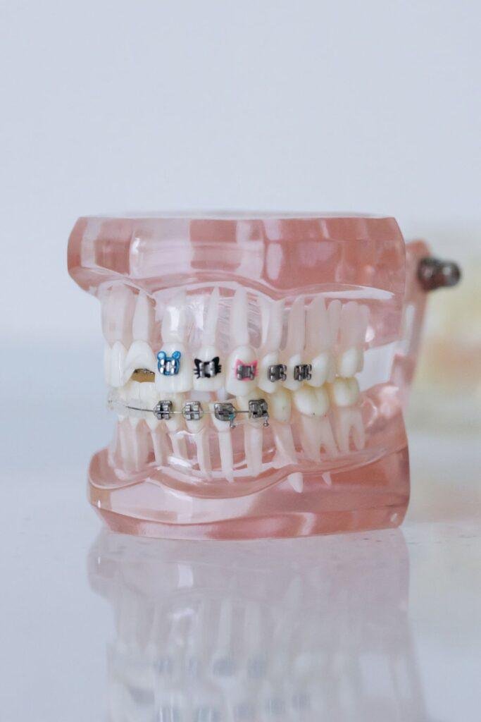 Dentist reassuring an anxious patient in Kitsilano Vancouver