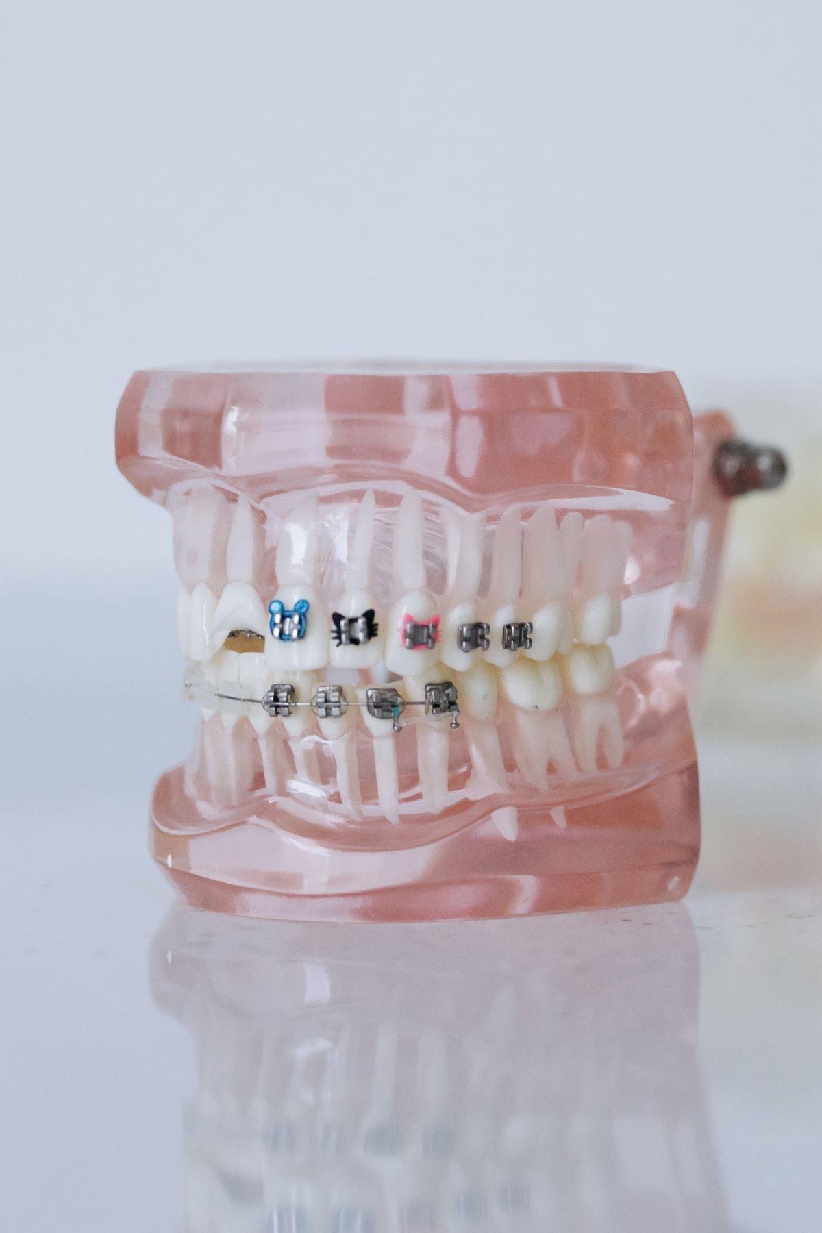 Dentist reassuring an anxious patient in Kitsilano Vancouver