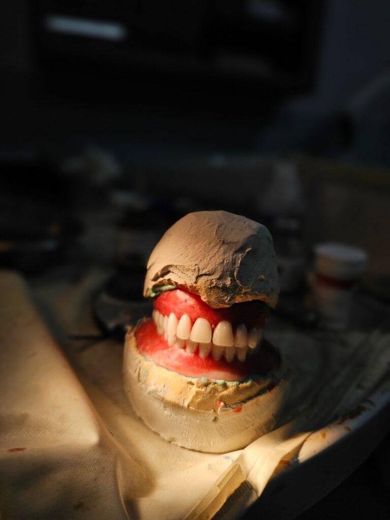 Set of complete dentures used for tooth replacement in Vancouver