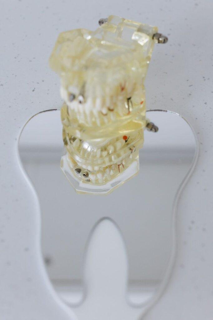 Root Canal Treatment in Kitsilano: Signs You Need One and What Healing Involves