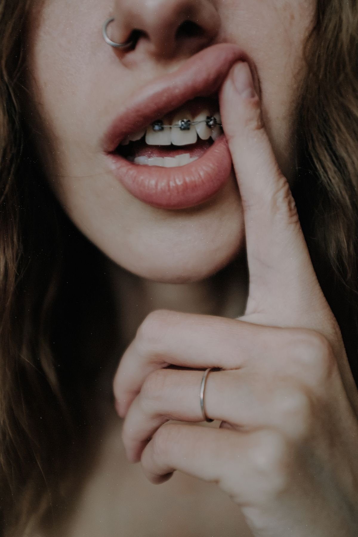 Person holding an orthodontic retainer