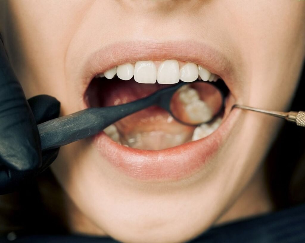 Dentist checking a patient's gums for recession at a Kitsilano dental clinic