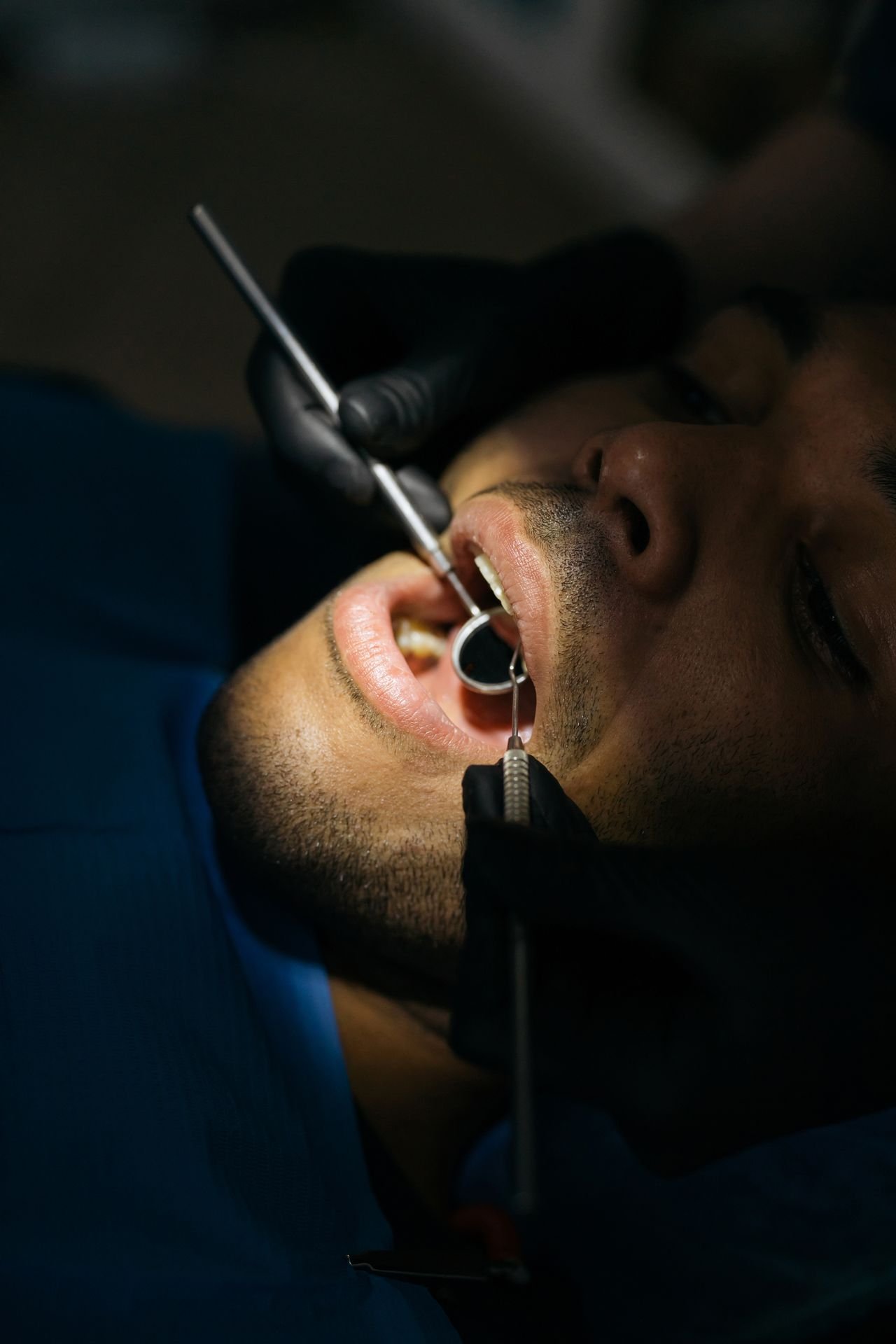 Man having a dental checkup to assess whether he needs a deep cleaning