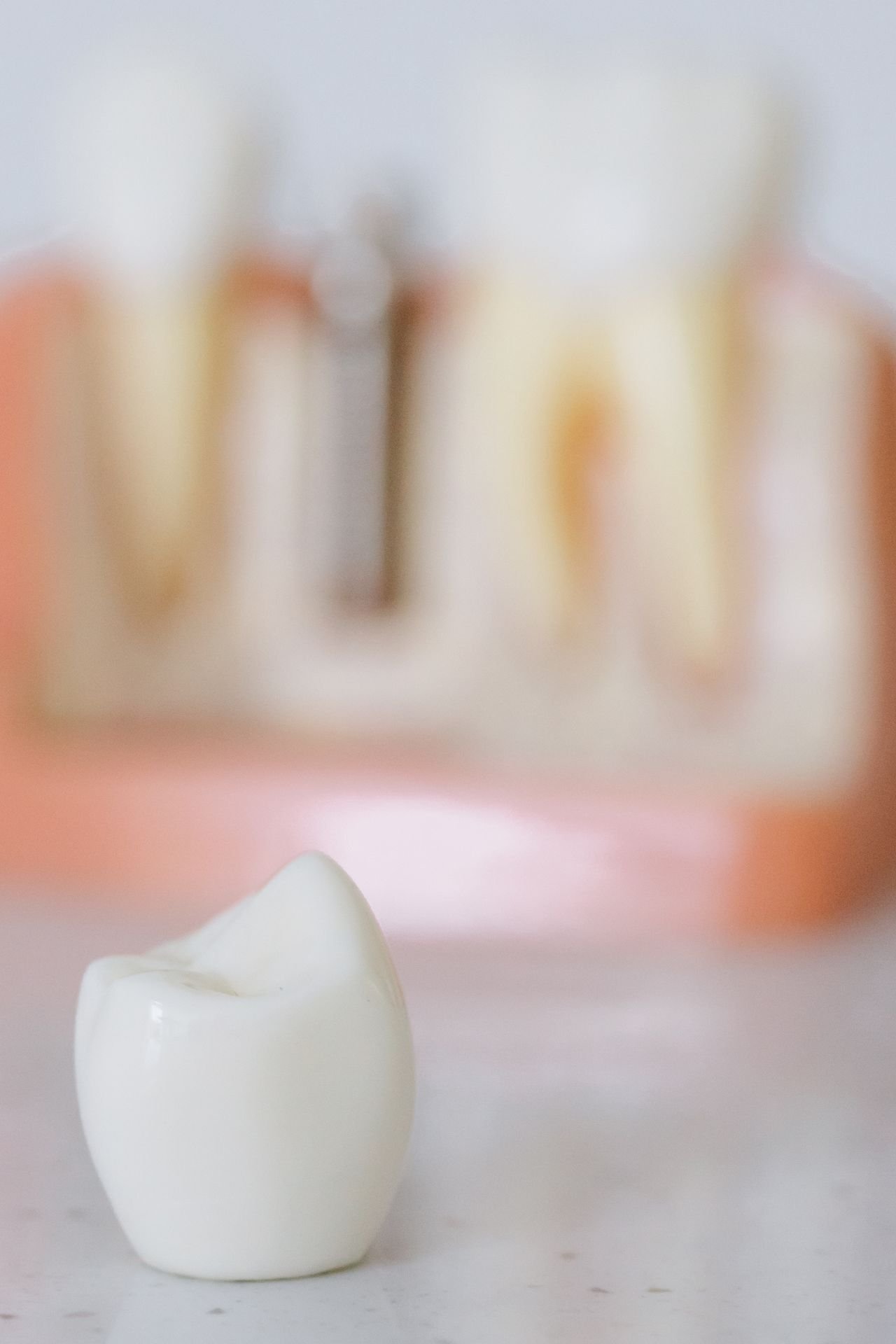 Close-up of a dental implant tooth model