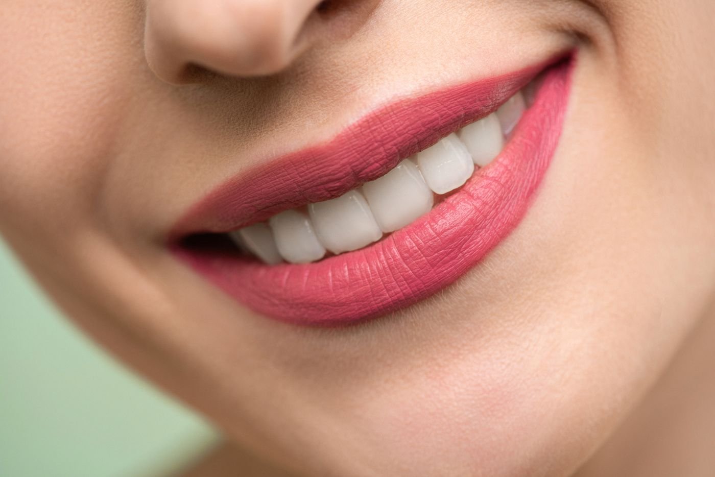Woman smiling and showing natural tooth shade before teeth whitening in Vancouver
